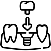 Prothetik